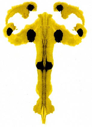 Bài trắc nghiệm tâm lý của Hermann Rorschach